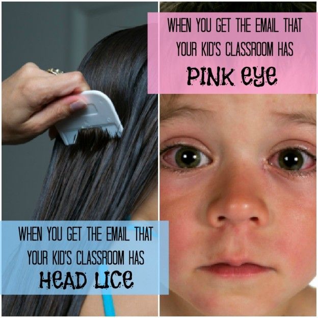 lice babies pictures, photos