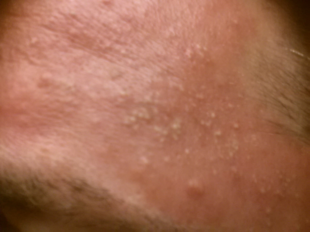 small-red-spots-on-face