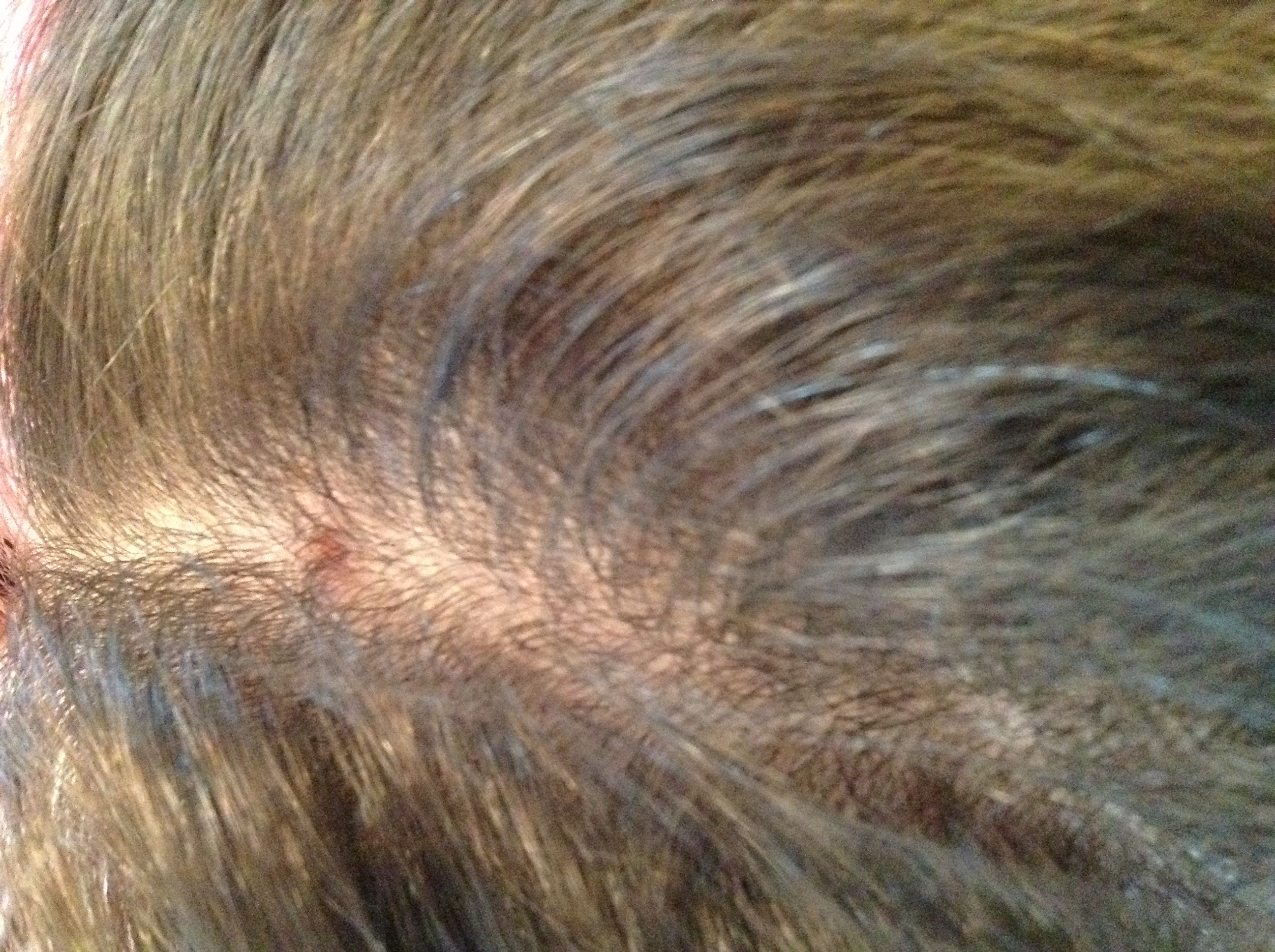 Red Spots On Scalp Pictures Photos 