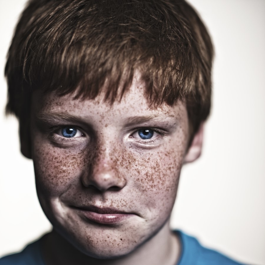 freckles on dark skin - pictures, photos