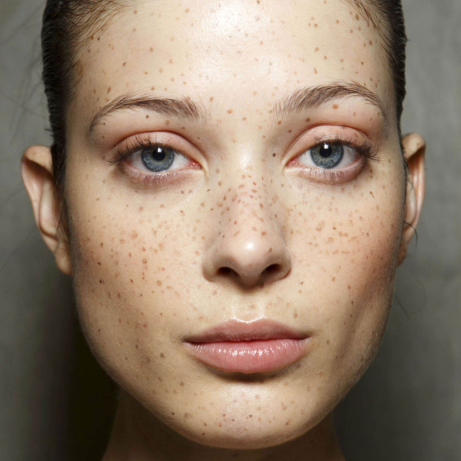 new freckle on face - pictures, photos