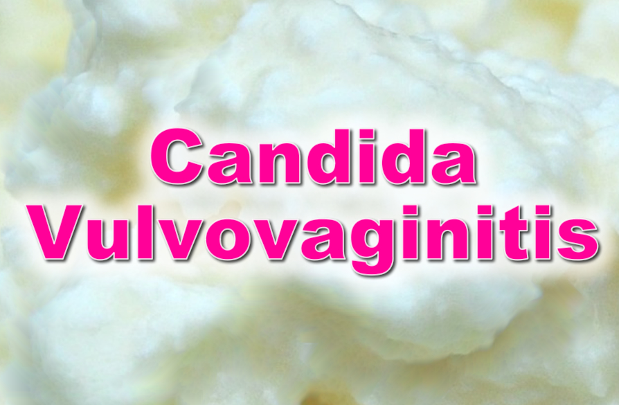 candida vulvovaginitis - pictures, photos