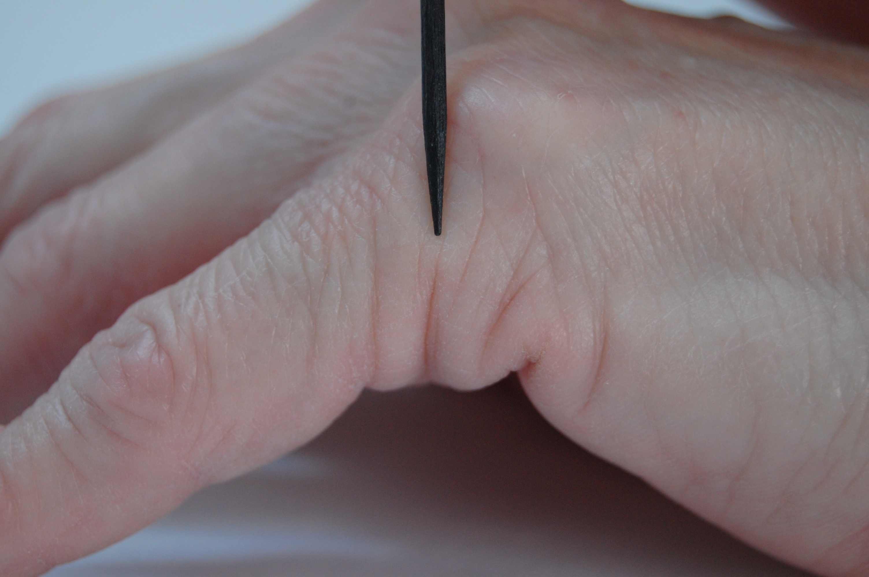 knuckle pad pictures, photos