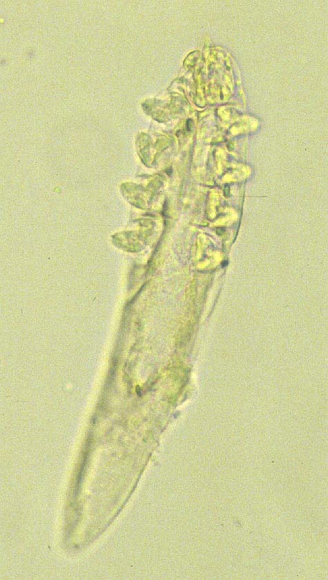 Demodex folliculorum фото