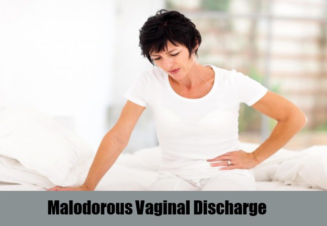 malodorous vaginal discharge - pictures, photos