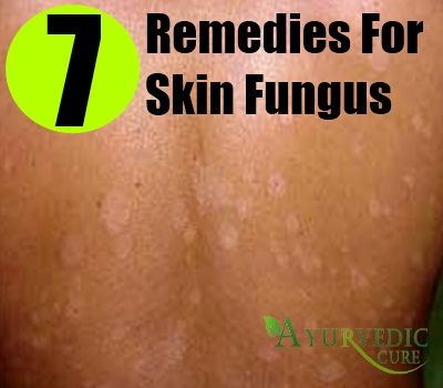 Fungus On Skin Treatment Pictures Photos