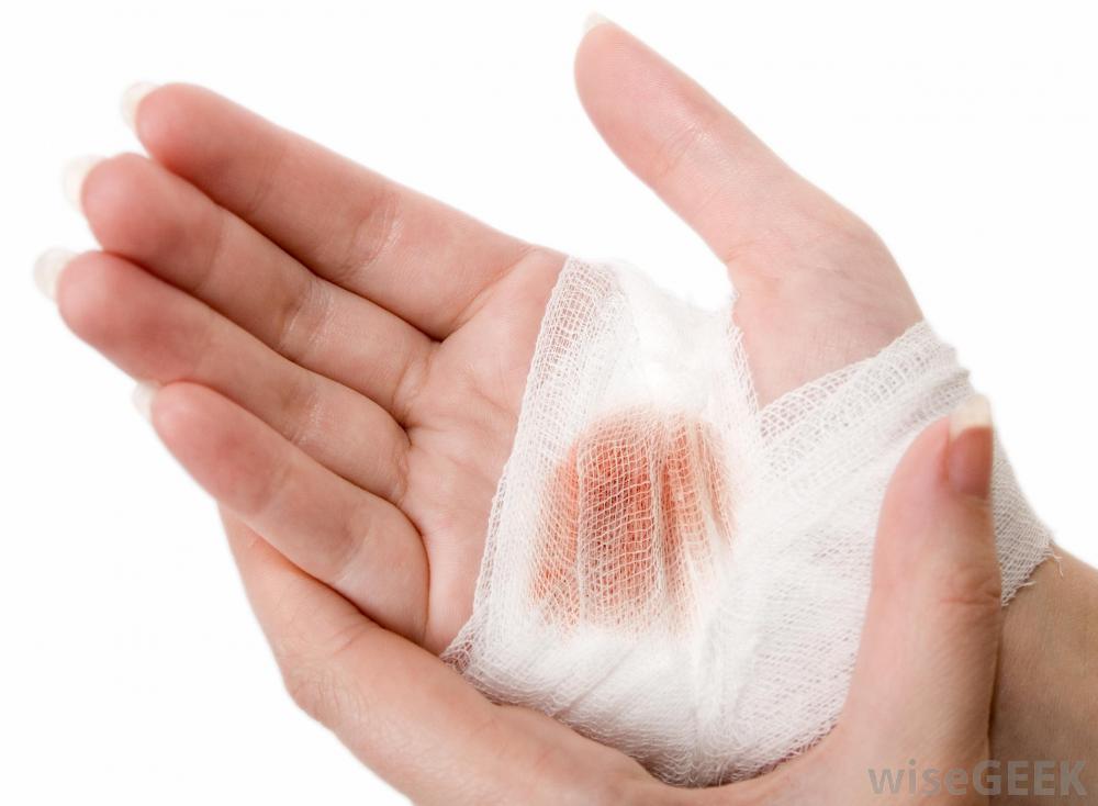 types of wound dressings - pictures, photos