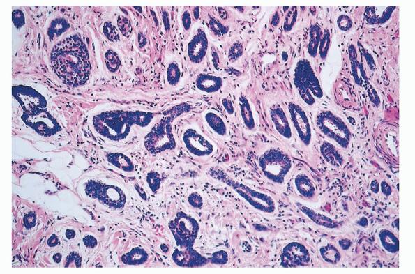 eccrine