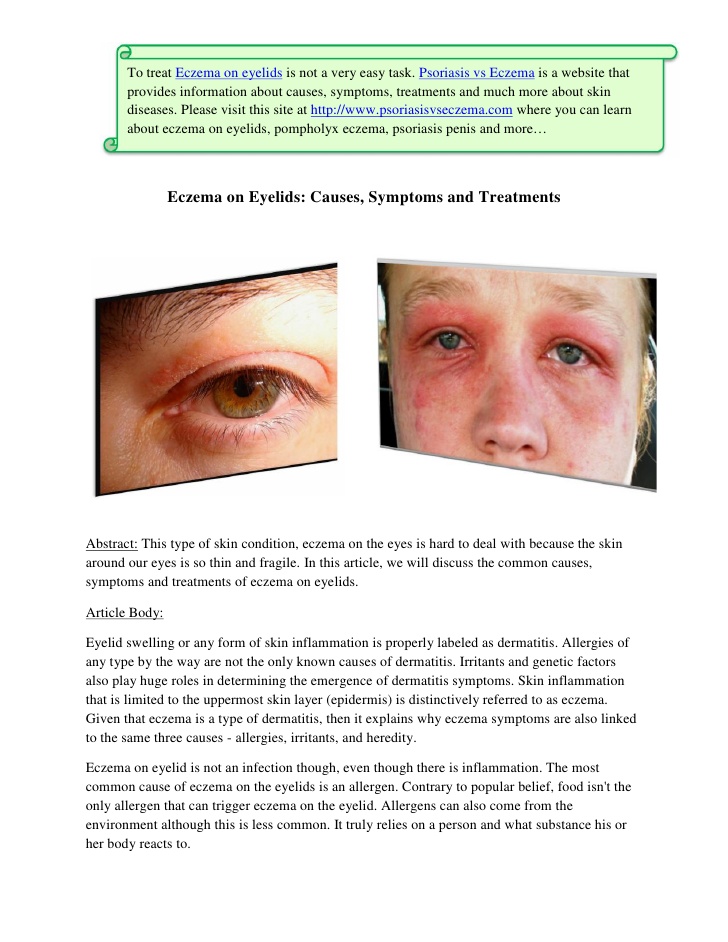 Eyelid Dermatitis