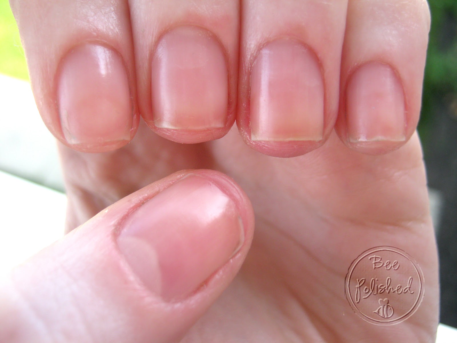 nail-separation-pictures-photos