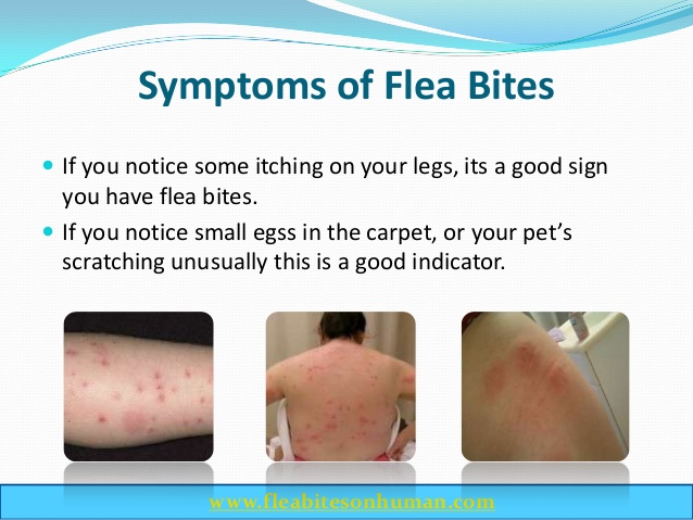 do flea bites itch