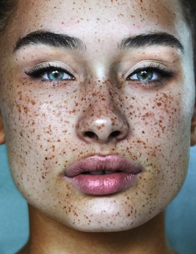 sun-freckles-pictures-photos