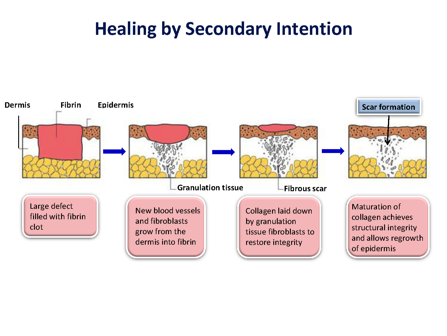 secondary-intention-healing-pictures-photos