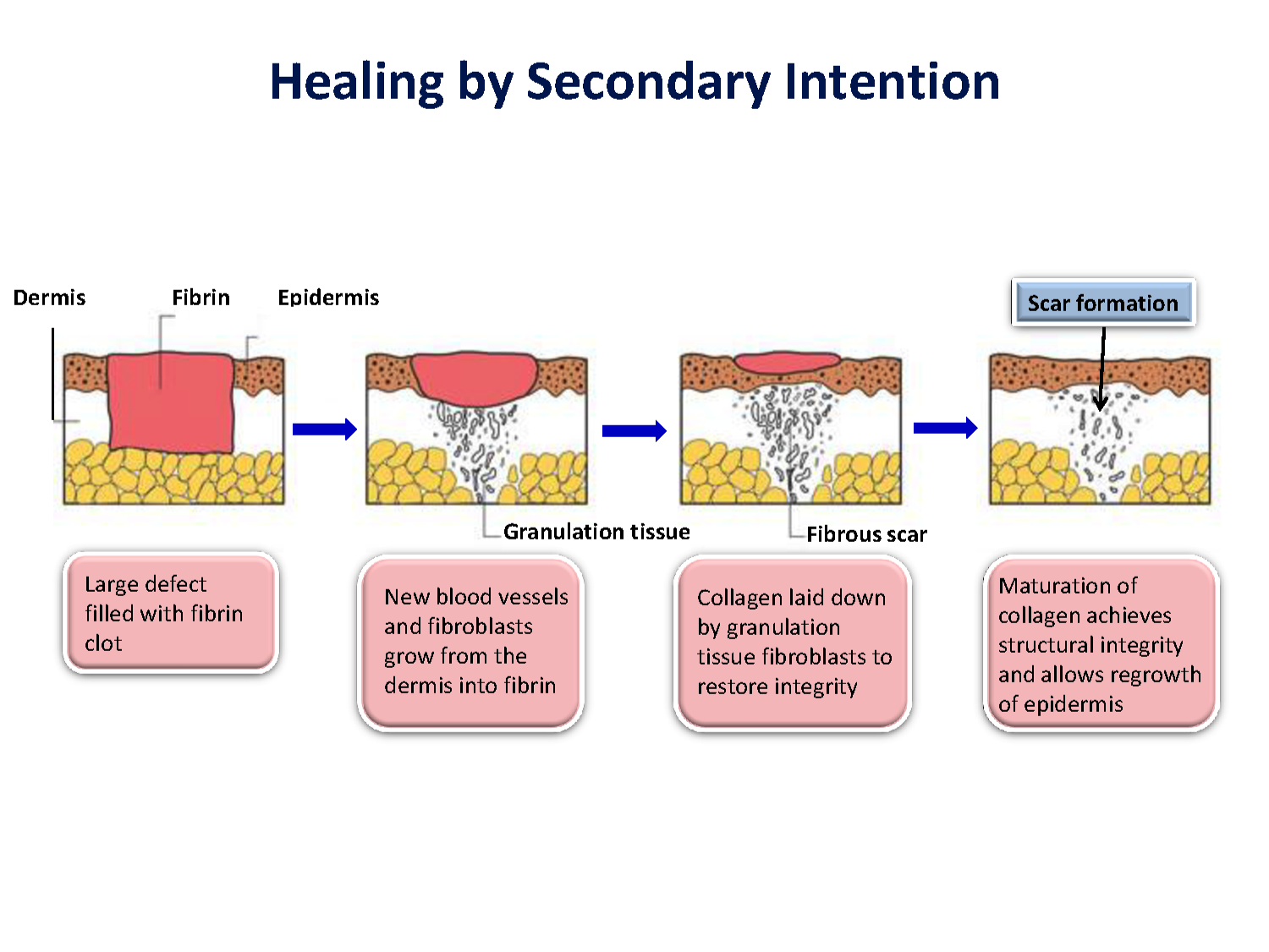 secondary intention healing - pictures, photos