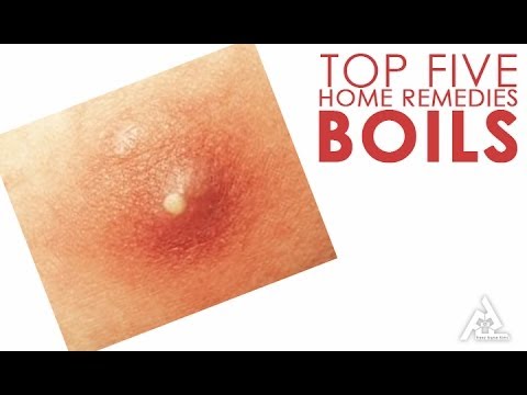 What causes boils on bottom