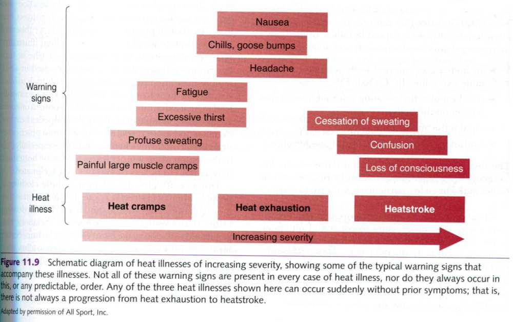 heat cramp symptoms pictures, photos