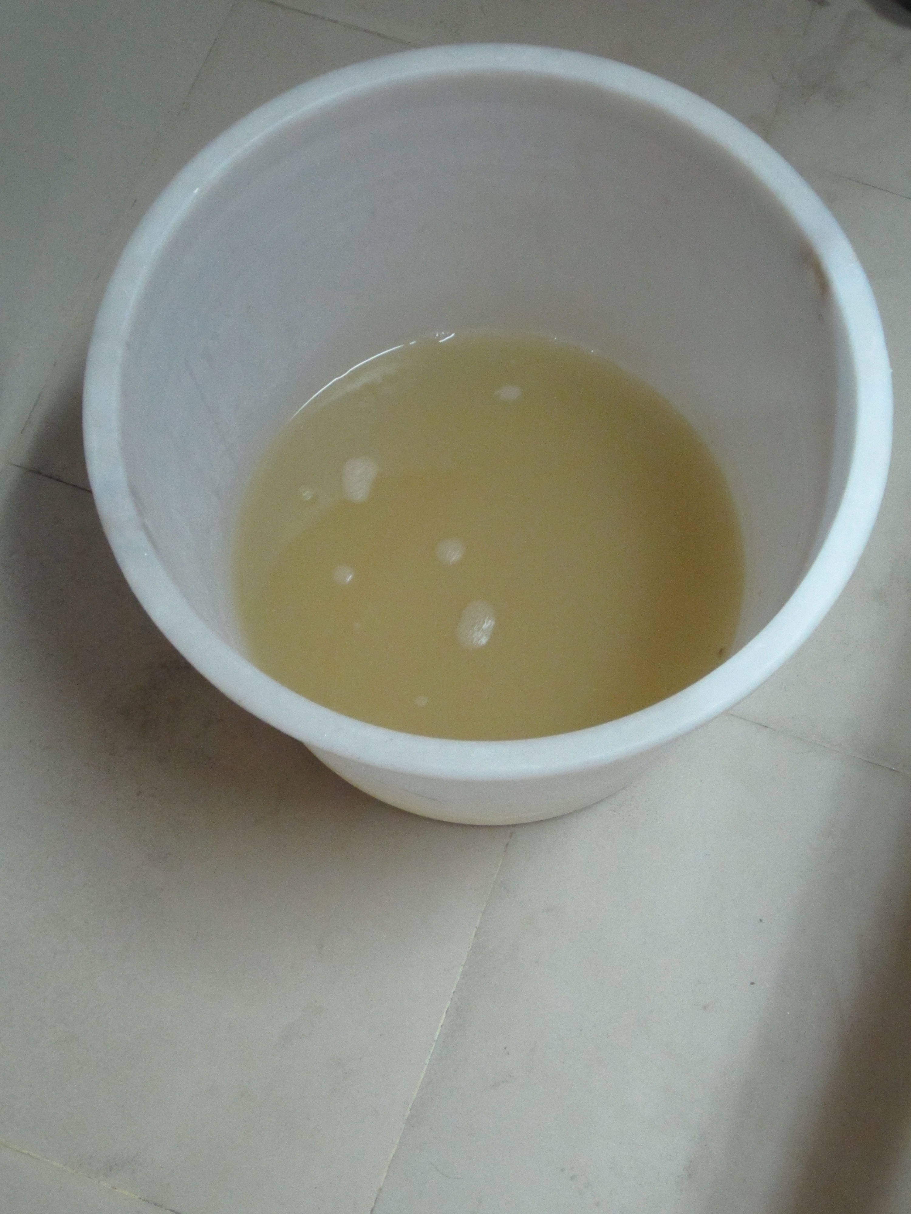 rice water stool pictures, photos
