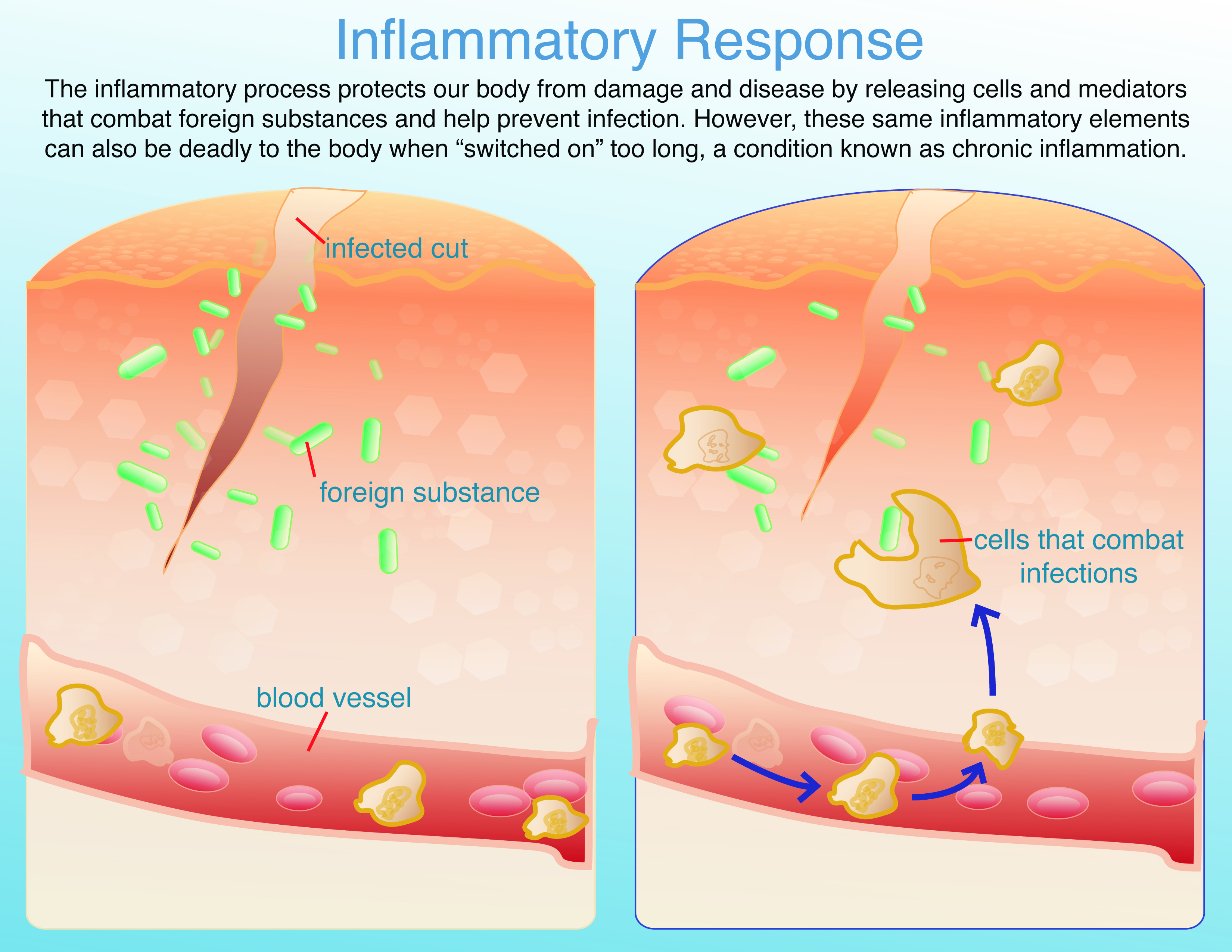 Skin Inflammatory Pictures Photos