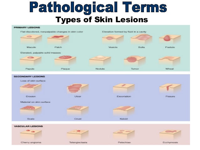 skin lesion description - pictures, photos