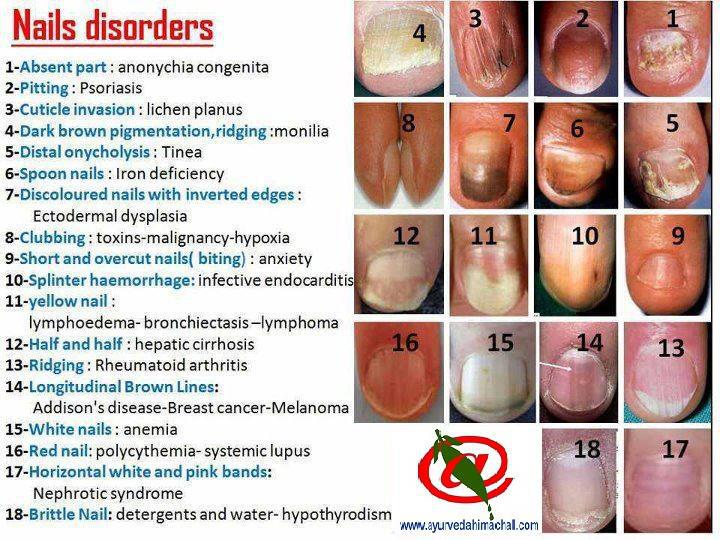 nail diseases and disorders - pictures, photos