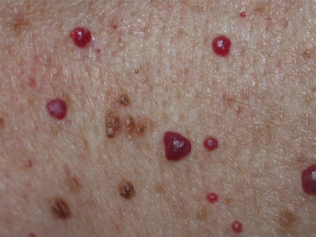 dermatology definition - pictures, photos