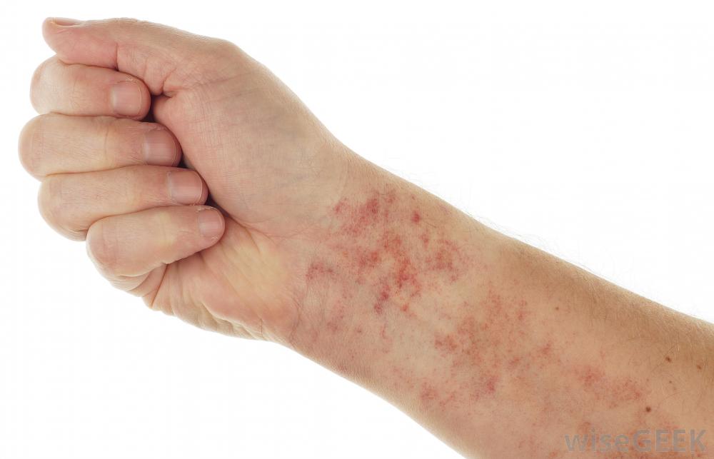 skin irritation on arm - pictures, photos