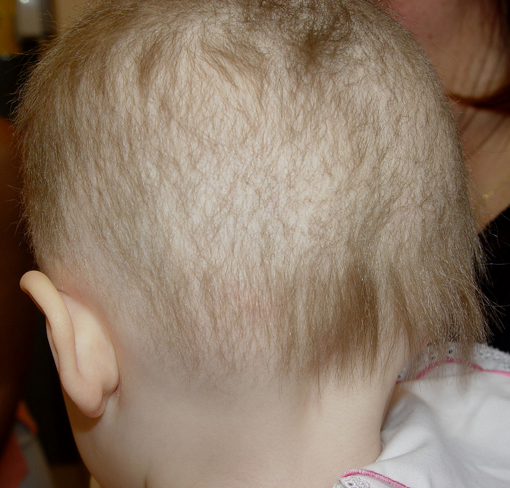 pili torti pictures, photos