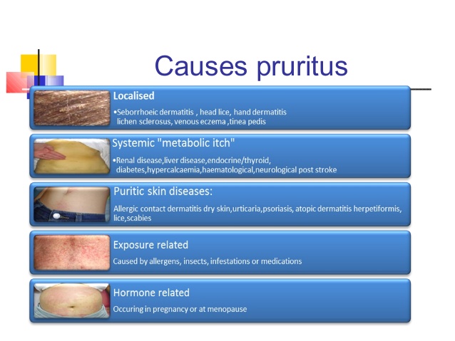 Causes Of Pruritus Pictures Photos