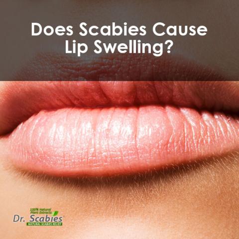 water blister on lips - pictures, photos