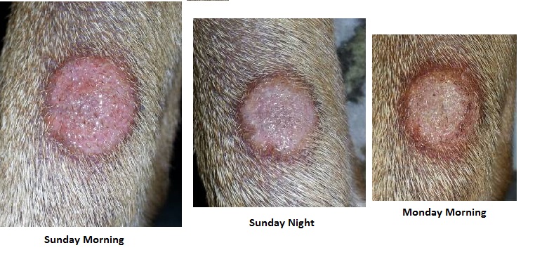 ringworm on leg - pictures, photos