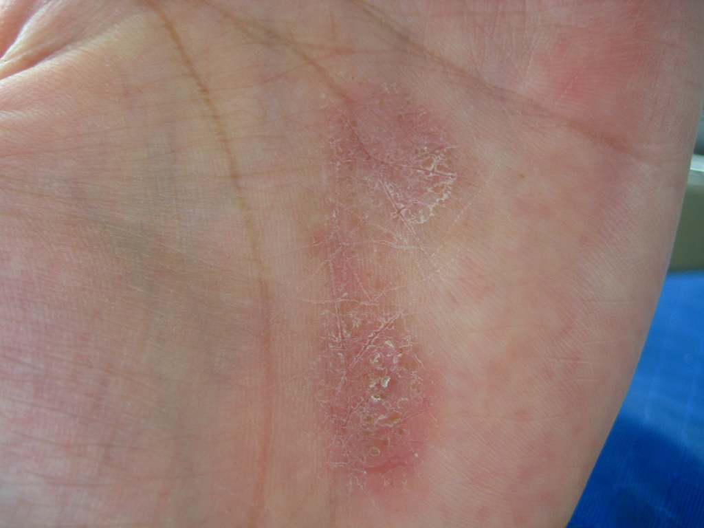 skin allergies pictures pictures, photos