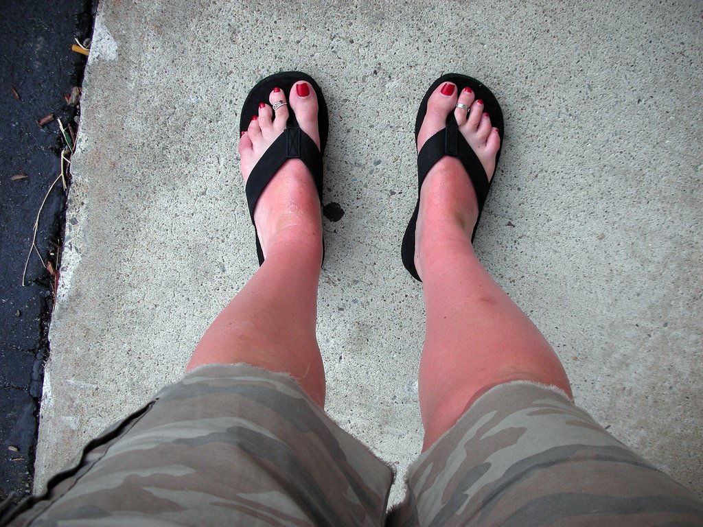 skin-cancer-on-feet-pictures-photos