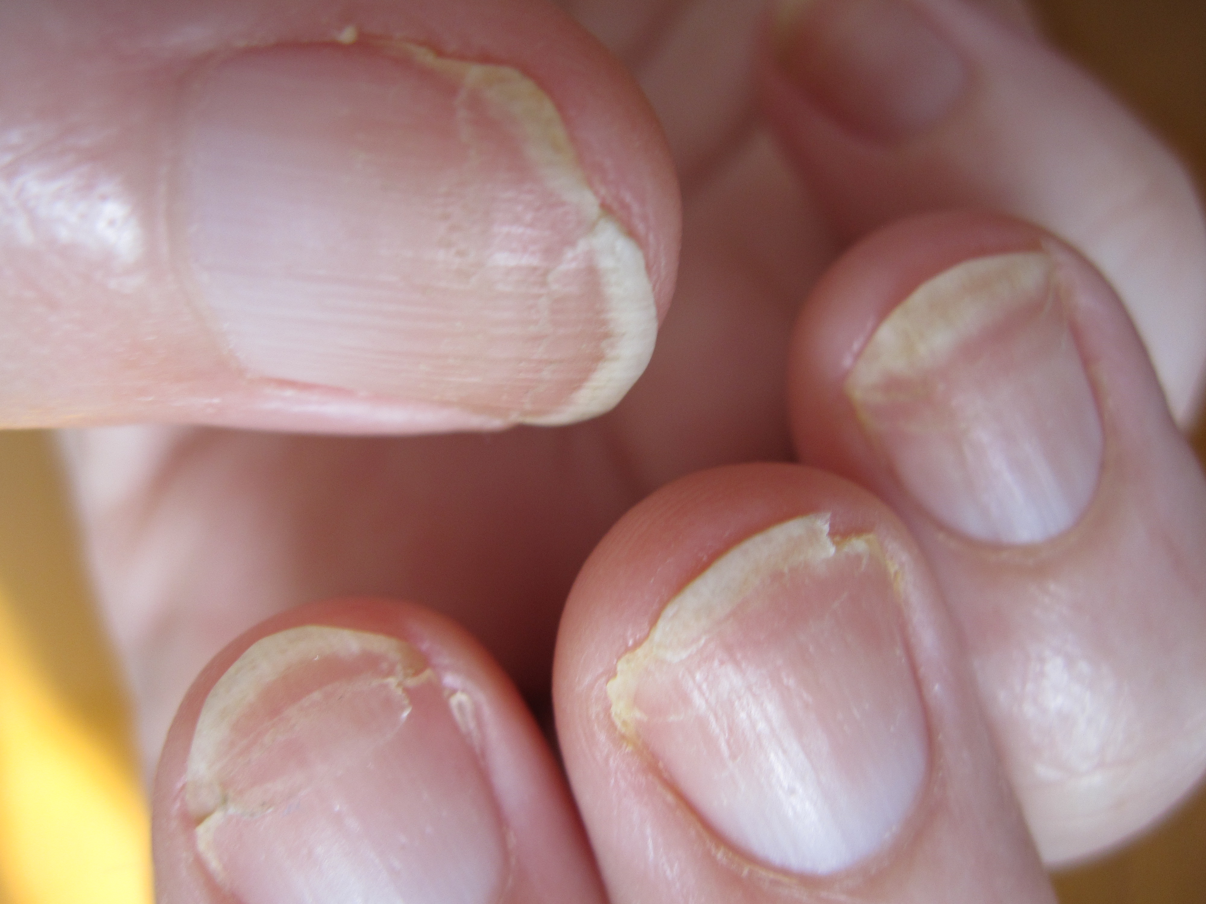 how-do-i-keep-my-nails-from-splitting